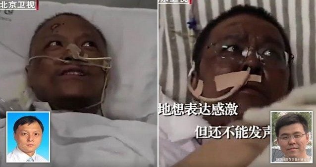 Medici cinesi diventano neri: colore della pelle cambia dopo la cura da Covid