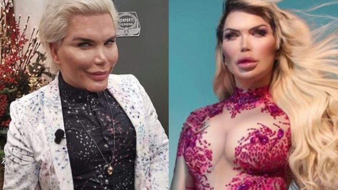 Da Ken umano a Barbie, la storia della transizione di Rodrigo Alves