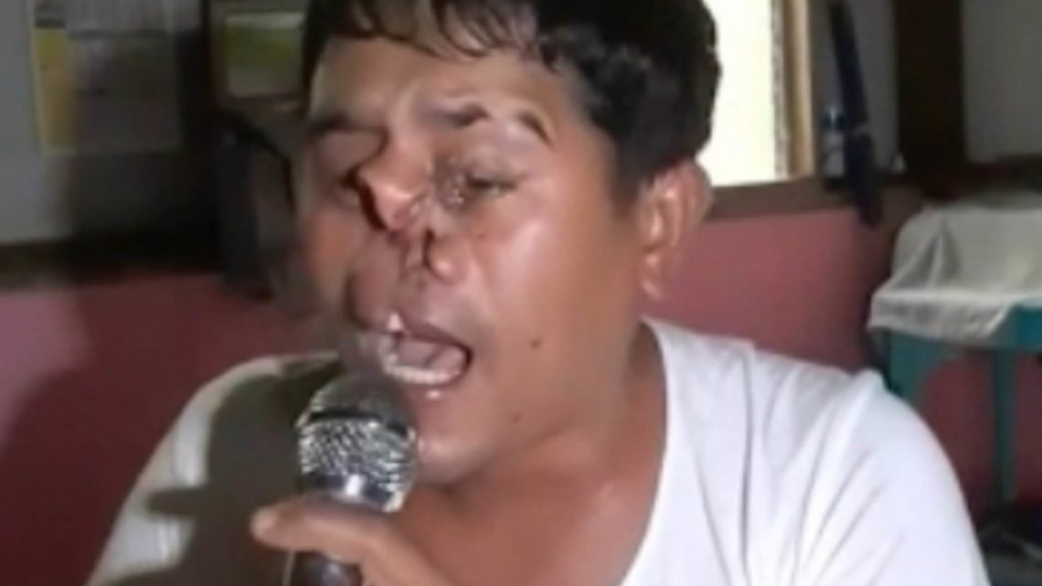 Nonostante le deformità, si esibisce su YouTube e le canta ai bulli: letteralmente – VIDEO Nonostante le deformità, si esibisce su YouTube e le canta ai bulli: letteralmente – VIDEO