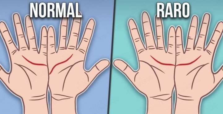 Il quiz del Precario illuminato sul palmo delle mani: com’è il vostro? Normale o raro?