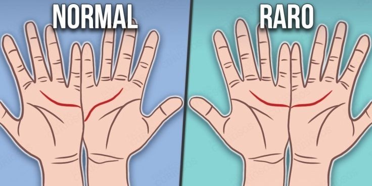 Il quiz del Precario illuminato sul palmo delle mani: com’è il vostro? Normale o raro?