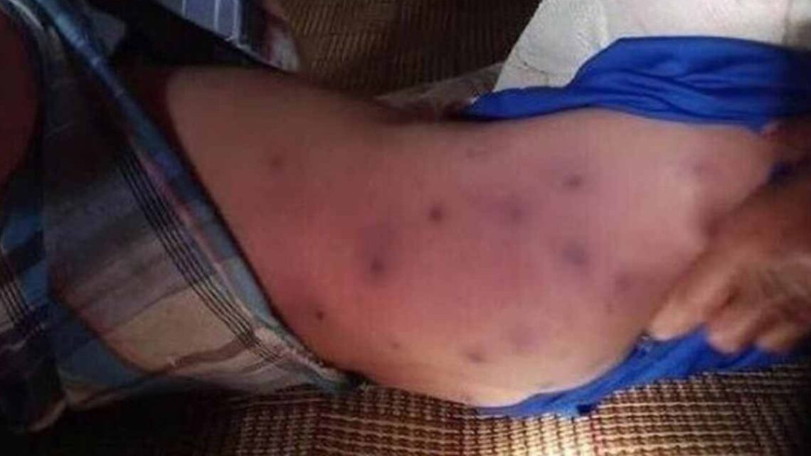 Un bambino muore a causa delle punture di un aggressivo calabrone tropicale Un bambino muore a causa delle punture di un aggressivo calabrone tropicale