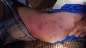 Un bambino muore a causa delle punture di un aggressivo calabrone tropicale Un bambino muore a causa delle punture di un aggressivo calabrone tropicale