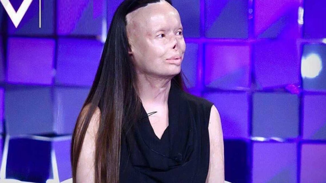 Chi è Valentina Pitzalis, donna sfigurata dal marito con il fuoco? Ecco i dettagli della sua storia Chi è Valentina Pitzalis, donna sfigurata dal marito con il fuoco? Ecco i dettagli della sua storia