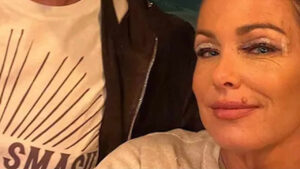 Sonia Bruganelli dal chirurgo estetico: sui social i risultati del ritocco – cos’è la blefaroplastica? Sonia Bruganelli dal chirurgo estetico: sui social i risultati del ritocco – cos’è la blefaroplastica?